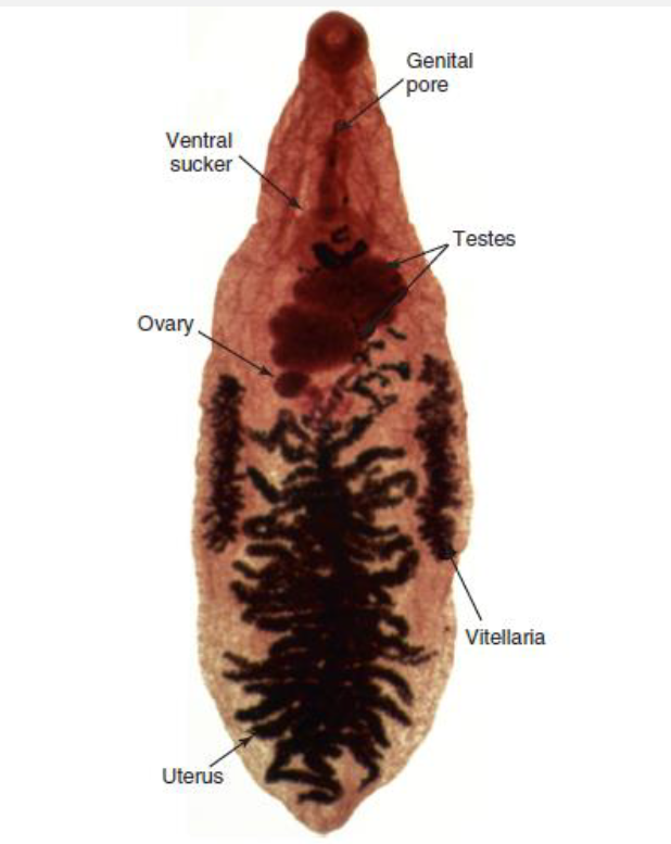 <p>Name this Trematode: Morphologic feature</p>