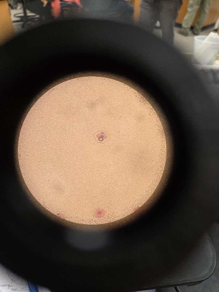 <ol><li><p>what is this structure?</p></li><li><p>what is the ploidy?</p></li><li><p>what is the ring inside?</p></li></ol><p></p>