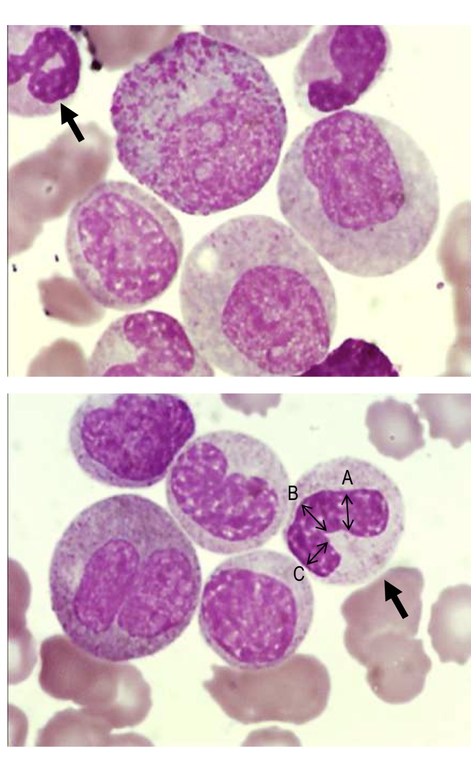 <p>Name this cell and the main points for identification</p>