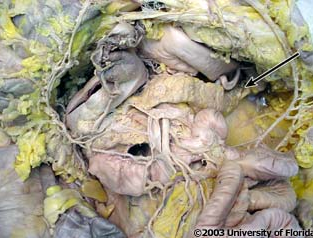 <p>what structure is being indicated to (be specfic)?</p>