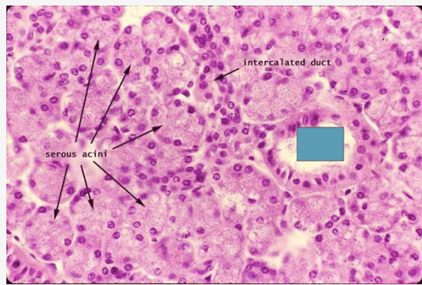 <p>Identify the following structure</p>