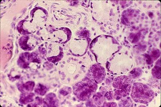 <p>mixed salivary gland</p>