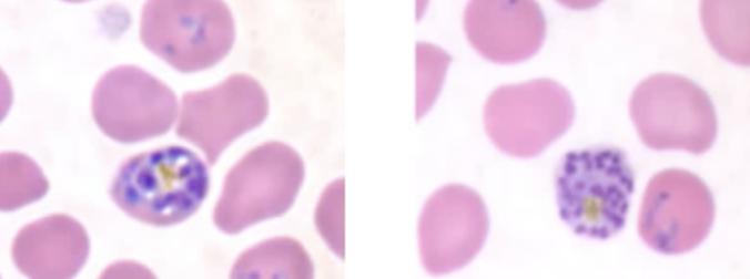 <ul><li><p><span style="background-color: transparent;">The schizont of Plasmodium falciparum is the only visible form in patients with severe infection.</span></p></li><li><p><span style="background-color: transparent;">The typical schizont contains <strong>24 merozoites</strong>, but it can contain anywhere from 8-36, and the cluster arrangement may also be present, but it is rarely seen.</span></p></li></ul><p></p>