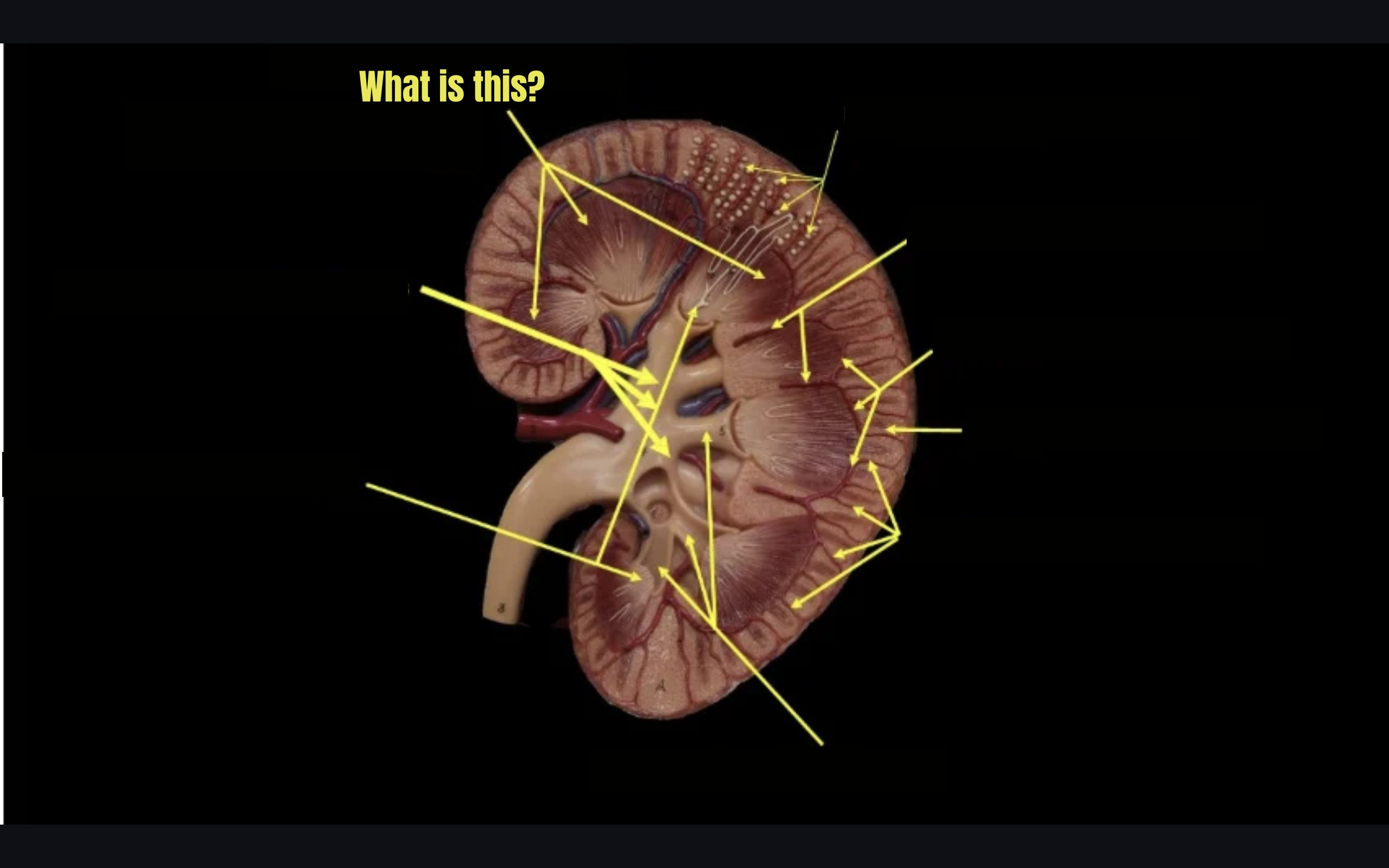 term image