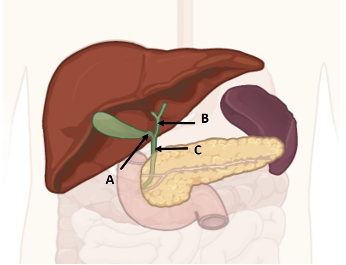 <p>A</p>