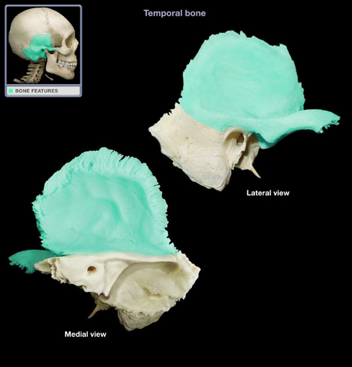 <p>What part of the bone is this?</p>