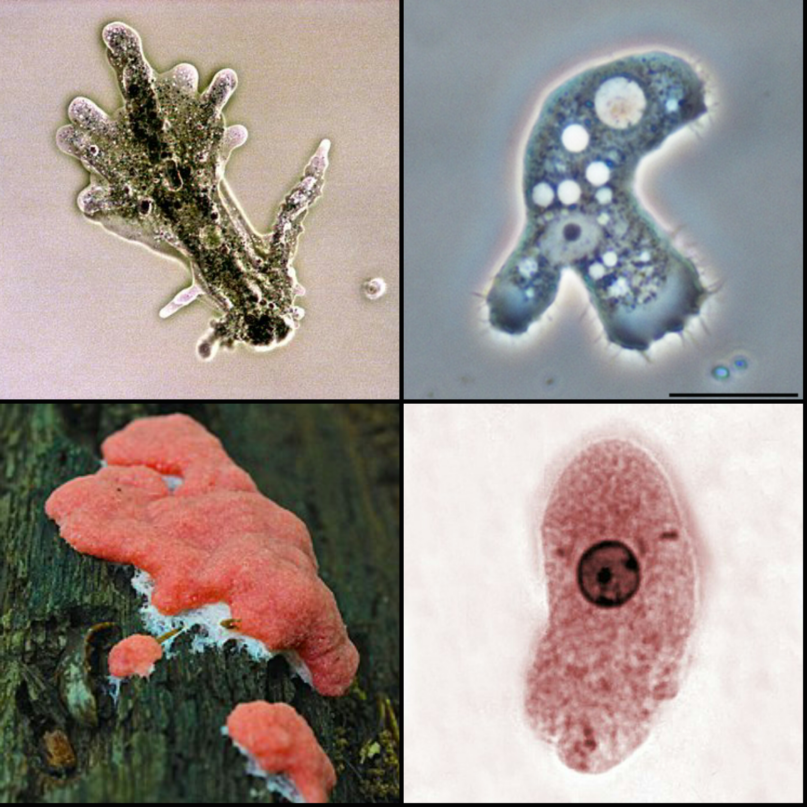 <p>Amoebozoa - Eukaryotes</p>