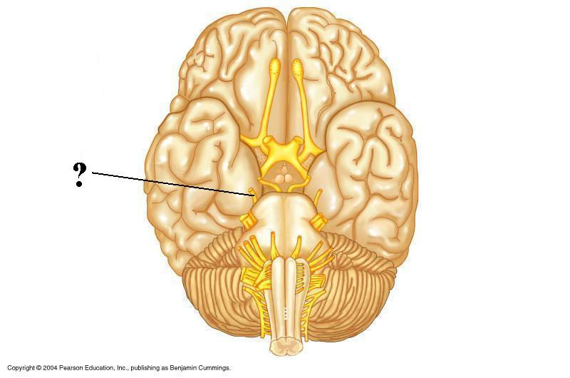 <p>Identify the indicated cranial nerve</p>