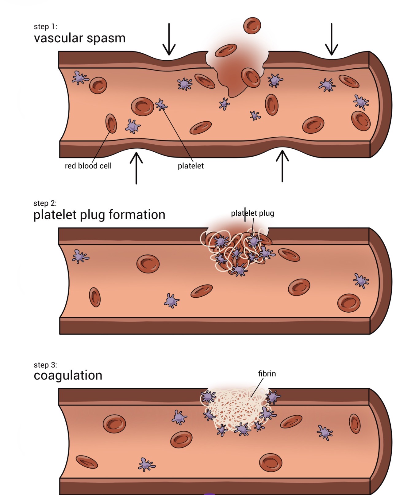 <p><span><span>1) </span></span><strong>Vascular Spasm:</strong><span><span> Immediate vasoconstriction to reduce blood flow. </span></span></p><p><span><span>2) </span></span><strong>Platelet Plug Formation:</strong><span><span> Platelets stick to exposed collagen and each other to form a temporary seal. </span></span></p><p><span><span>3) </span></span><strong>Coagulation:</strong><span><span> Blood clotting; a cascade of factors results in a fibrin mesh that traps RBCs.</span></span></p>