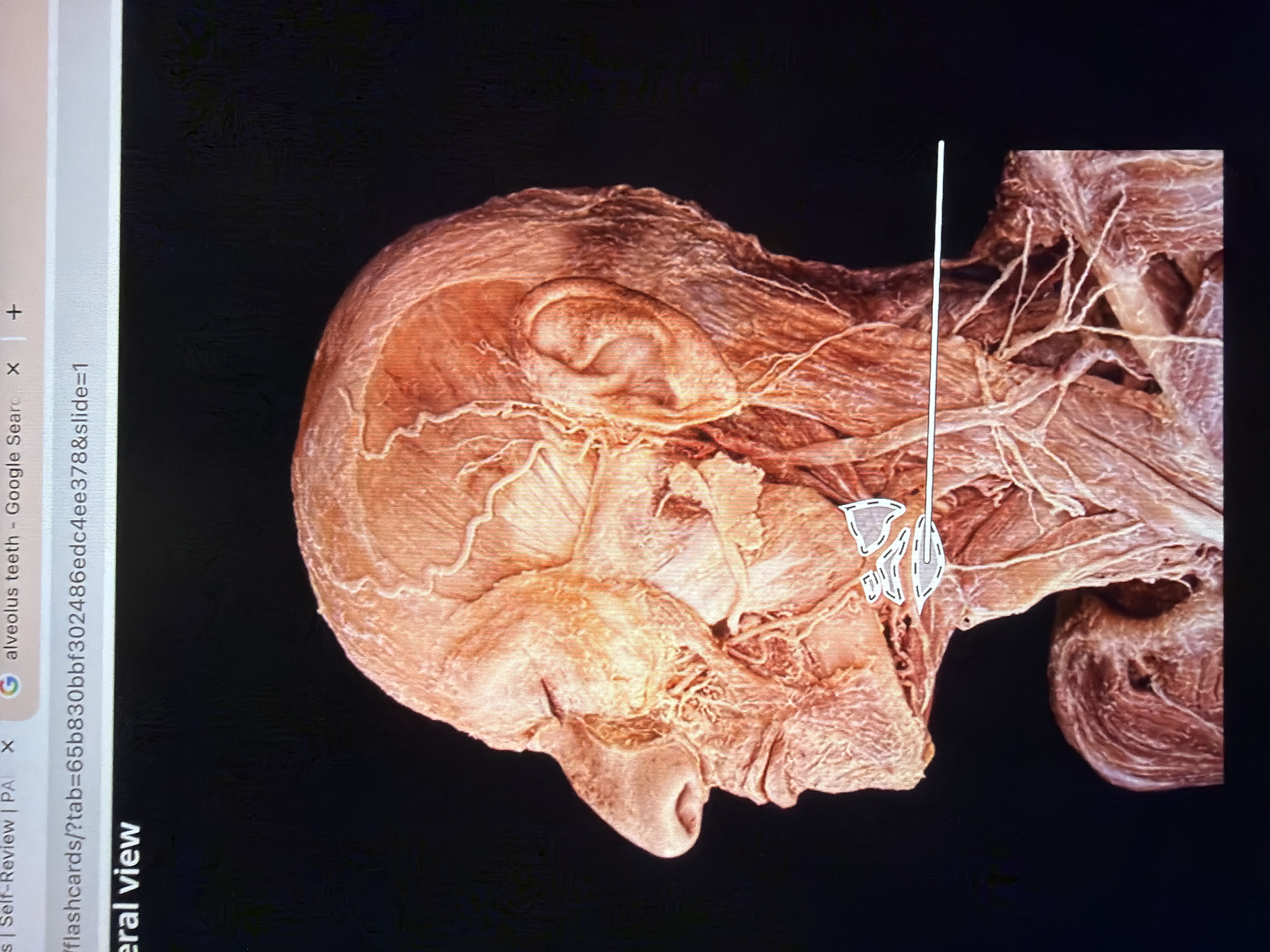 term image
