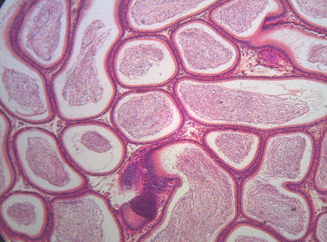 <p><span>Where part of the body is seen in this image?</span></p>