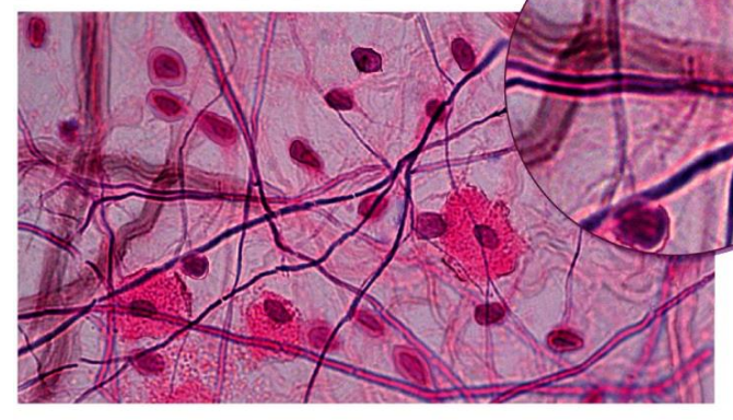 <ul><li><p>gel-like matrix (has all 3fiber types_ </p></li><li><p>packages organs </p></li><li><p>surrounds capillaries </p></li><li><p><strong>FUNCTION </strong>→ cushions, supports, and reservoir for salt &amp; water </p></li></ul><p></p>