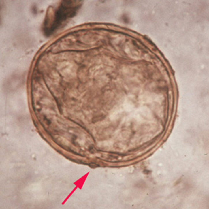 term image