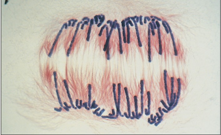 <p>What stage of mitosis is this? </p>