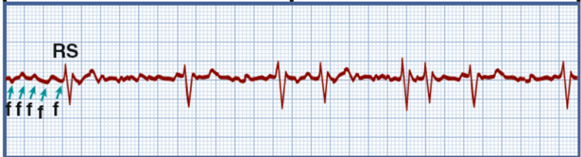 <p>What rhythm is this?</p>