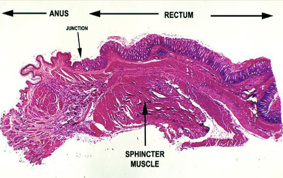 <p>recto - anal junction: rectal region, anal region, anal sphincter, stratified squamous epithelium, simple columnar epithelium, goblet cells</p>