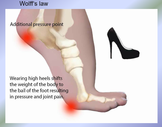 <p>More evidence for Wolff’s Law</p>