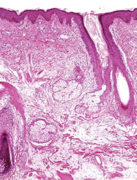 <p>What is the bottom layer of this image?</p>