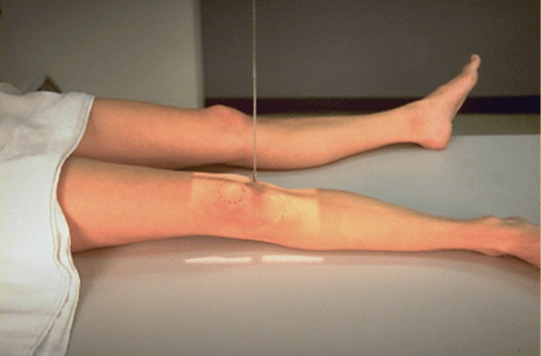 <p>projection?</p>