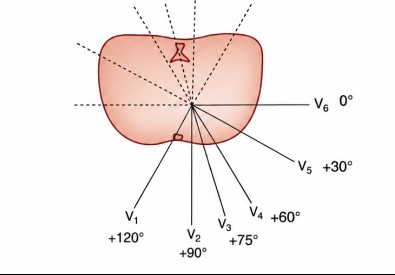 <p>V1→V6</p>