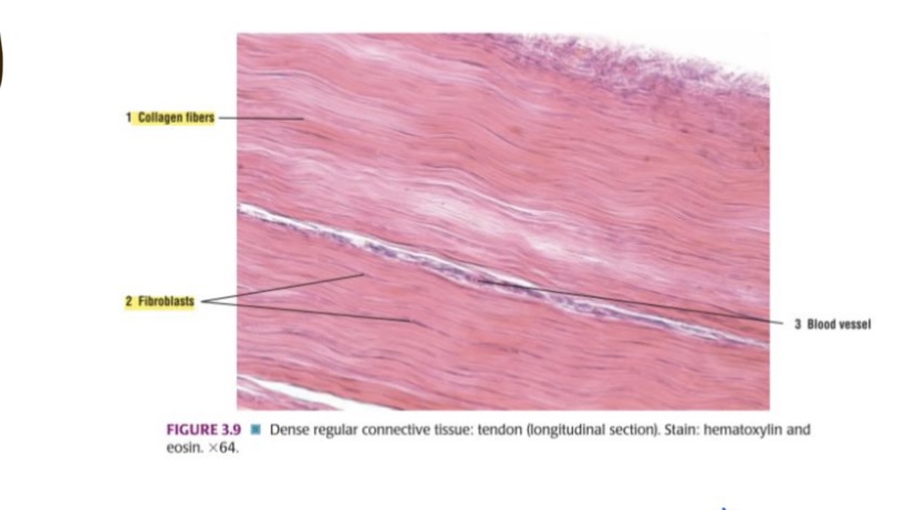 <p>What type of tissue is this?</p>