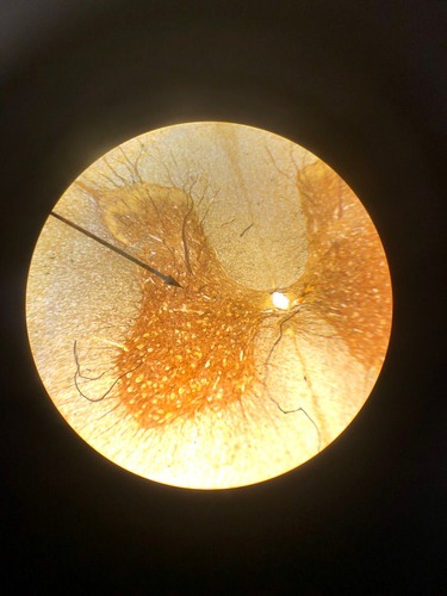 <p>Identify the general name for this darker nervous tissue.</p>