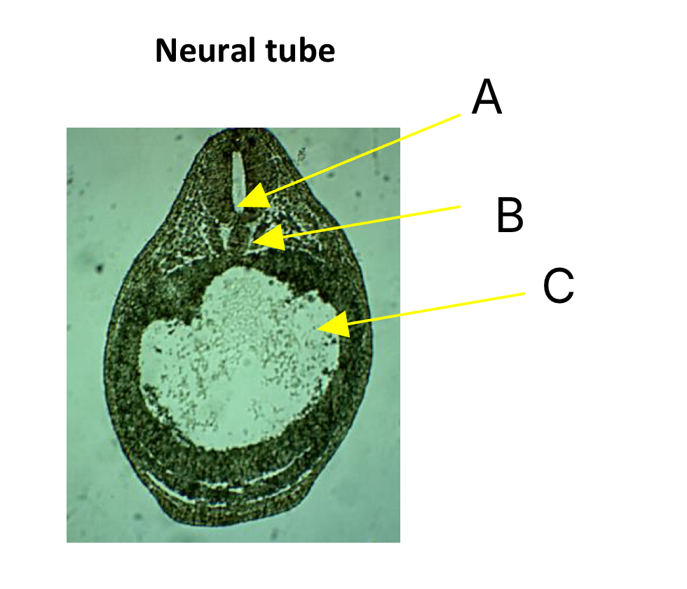 <p>Name A, B, and C</p>