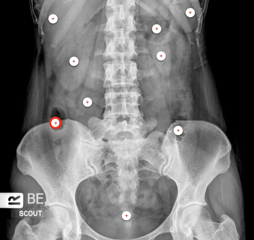 <p>what structure is the red circle labeling? </p>