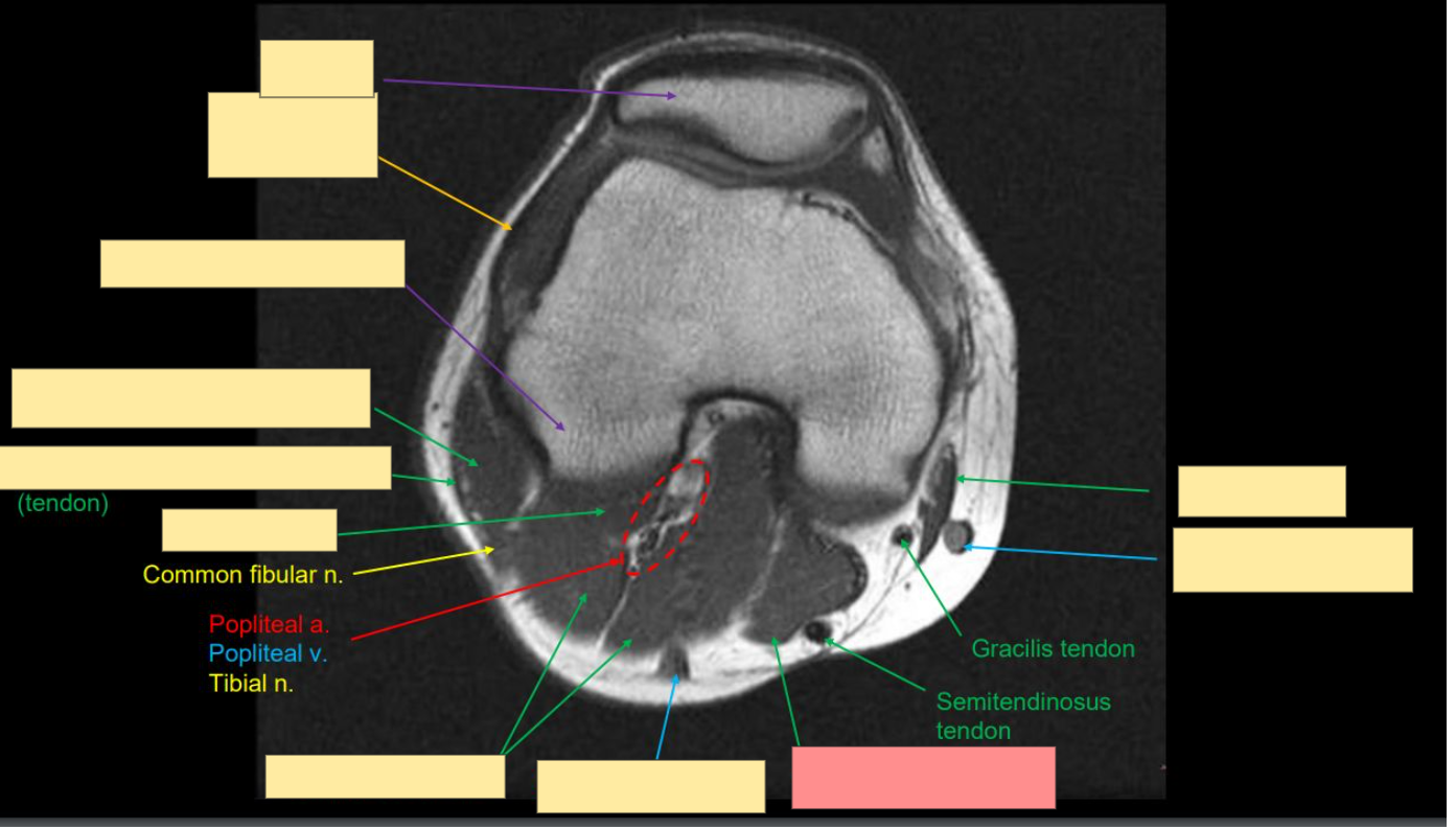 <p>Identify this structure </p>