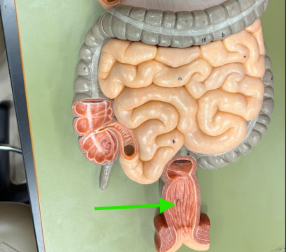 <p>What is the arrow pointing at?</p>