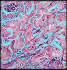 <p>Identify the highlighted structure</p>