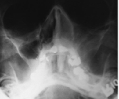 <p>what is this condition</p>