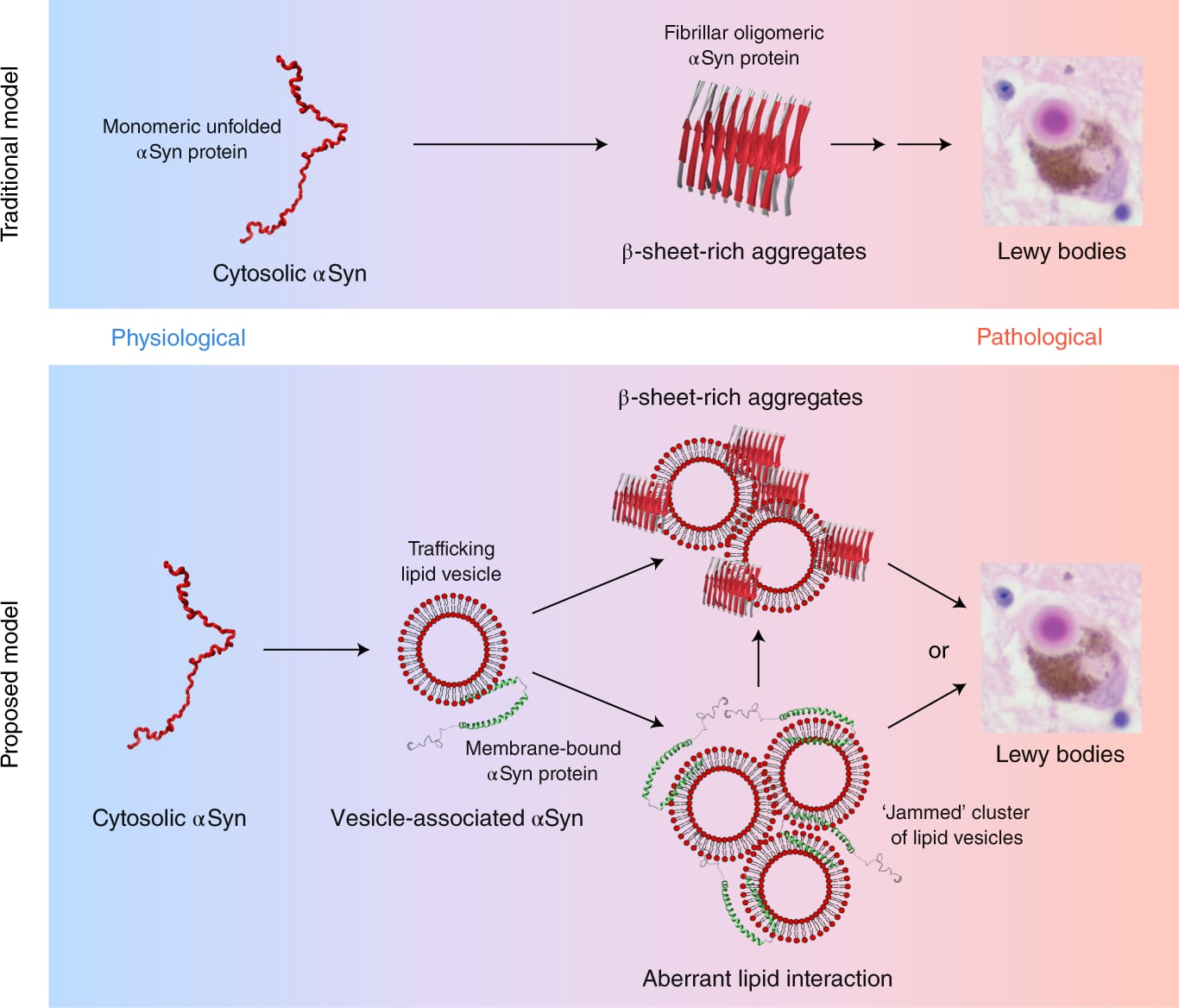 <p><span style="color: red;">C. α-synuclein</span></p><ul><li><p><span style="background-color: transparent;"><strong>Bệnh Parkinson</strong>: thoái hoá neuron ở <strong>chất đen</strong> (Substantia nigra)</span></p></li><li><p><span style="background-color: transparent;"><strong>Thể Lewy</strong>: do sự tích tụ các <strong>protein ⍺-syn</strong> dưới dạng <strong>β-sheet</strong> không tan trong nước, gây độc cho ty thể của neuron dopamine, tạo lỗ thủng trên màng tế bào gây rò rỉ ion</span></p></li><li><p><span style="background-color: transparent;">Triệu chứng "<strong>run khi nghỉ</strong>" và "<strong>cứng đờ</strong>" là hệ quả của việc mất đi tác dụng ức chế của Dopamine lên các nhân nền.</span></p></li></ul><p></p>