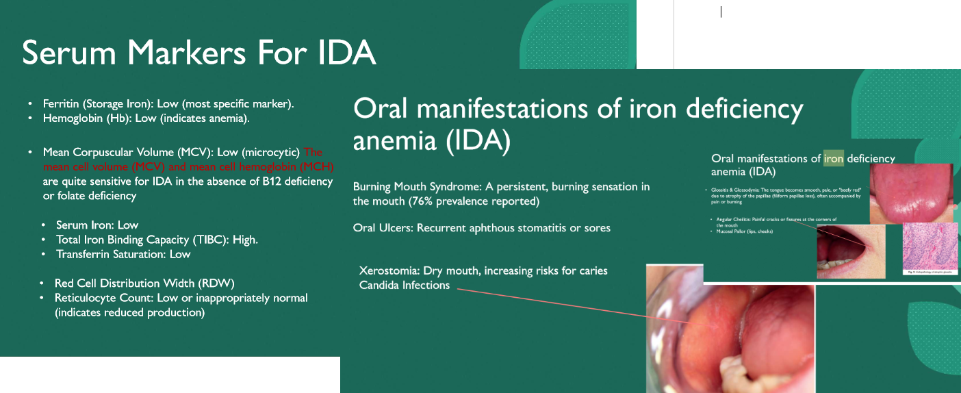 <p>Iron deficiency anemia </p>