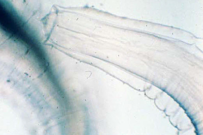 <p>Identify the parasite which is commonly found in the stomach contents of small animals.</p>