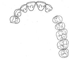 <p>What kennedy classification?</p>