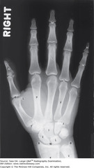 <p>an image of a patient's anatomic part(s) produced by the action of x-rays on an image receptor (bones absorb more x-rays appearing white)</p>