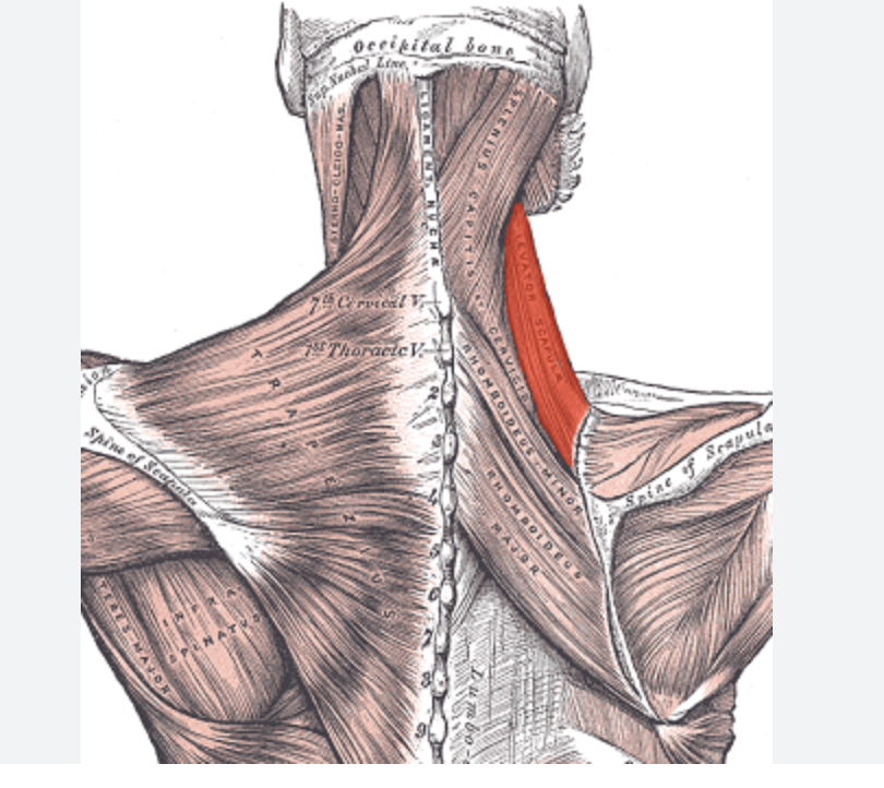 <p>Identify the highlighted muscle </p>
