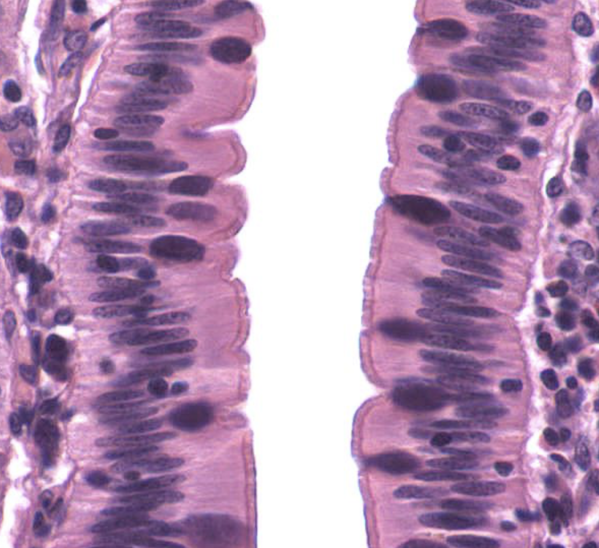 <p>tissue type</p>