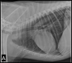 <p>Identify the opacity in the pleural space:</p><p>a. normal</p><p>b. air</p><p>c. soft tissue</p>