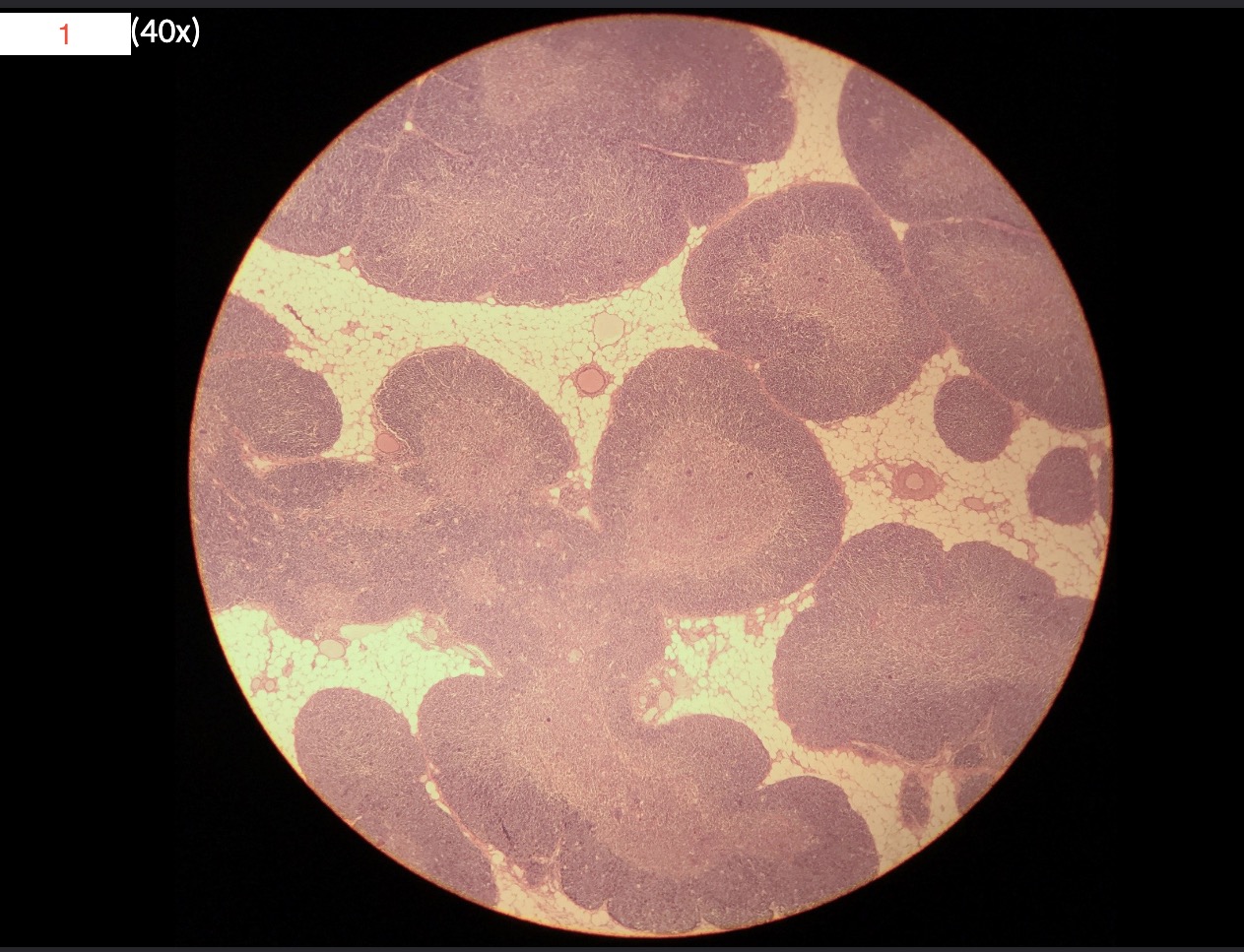 <p>1- What is this slide?</p>