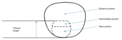 <p>Method of measuring trifocals where a line is drawn represented the trifocal and the subject has to determine if the placement is adequate. (need to consider if frame is large enough to accommodate trifocal)</p>