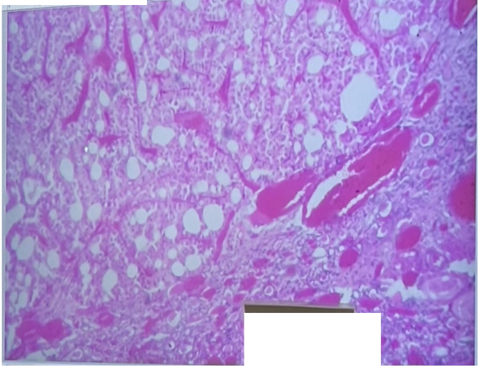 <ol><li><p>Sickle Cell Anemia</p></li><li><p>Atherosclerosis</p></li><li><p>Adenocarcinoma of Kidney</p></li><li><p>Osteogenic Sarcoma of Bone</p></li><li><p>Tattoo in Human Skin</p></li><li><p>Neurilemmoma</p></li><li><p>Anthracosis of the Lung</p></li><li><p>Basal Cell Carcinoma</p></li><li><p>Lung</p></li><li><p>Skeletal</p></li><li><p>Kidney</p></li><li><p>Neuron</p></li><li><p>Skin</p></li><li><p>Blood</p></li><li><p>Bone</p></li><li><p>Aorta</p></li></ol><p></p>