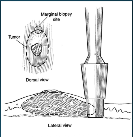 <p>What type of biopsy method is this? </p>