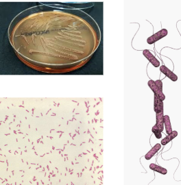 <p>What are the unique characteristics of Stenotrophomonas maltophilia?</p>