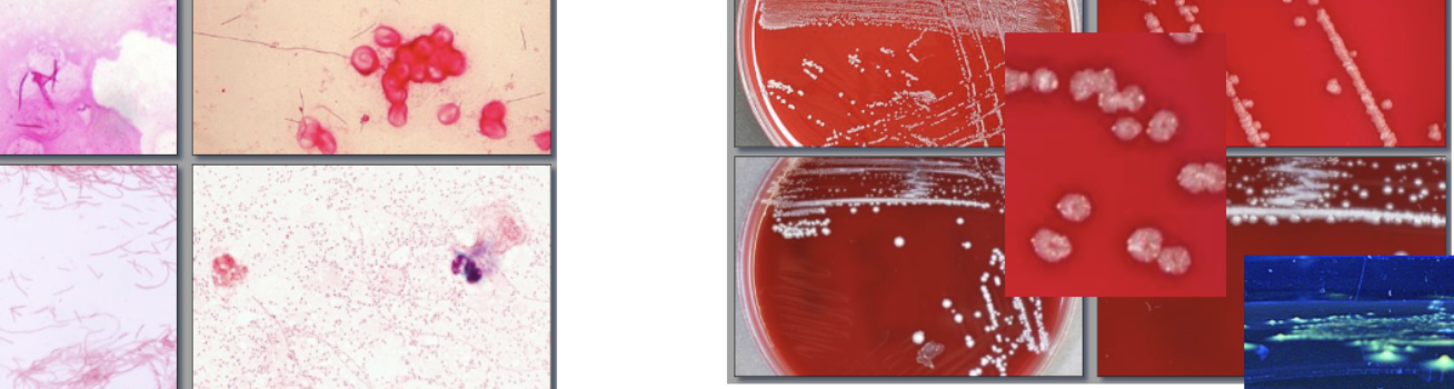 <p>GNR, sharply pointed or tapered ends, ANA BAP- bread crumb (white), speckled or smooth (gray-white), green agar with air, fluoresces chartreuse (yellow-green), gamma</p>