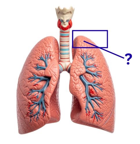 <p>Identify the part of the lung highlighted below.</p>