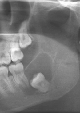 <p>what is the most likely diagnosis? </p>