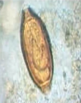 <p>type of egg, and what nematode</p>