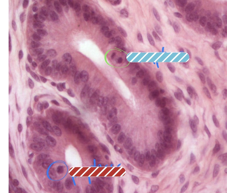 <p>What stage of mitosis is this cell in (blue circle)</p>